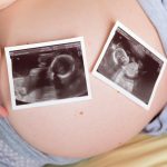 Tout ce qu’il faut savoir sur la grossesse gémellaire
