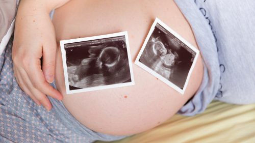 Tout ce qu’il faut savoir sur la grossesse gémellaire